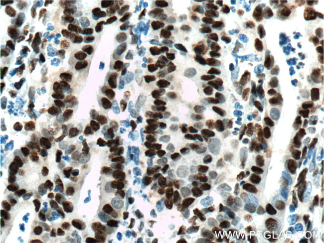 DACH1 Antibody in Immunohistochemistry (Paraffin) (IHC (P))