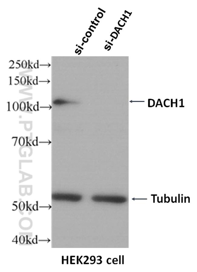 DACH1 Antibody in Western Blot (WB)