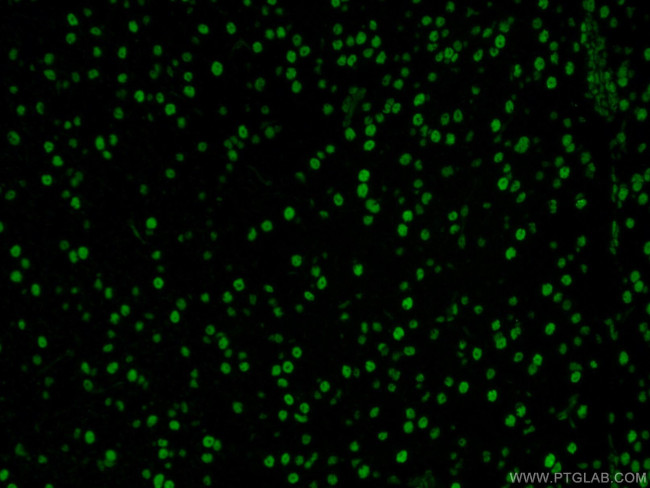 DACH1 Antibody in Immunohistochemistry (PFA fixed) (IHC (PFA))