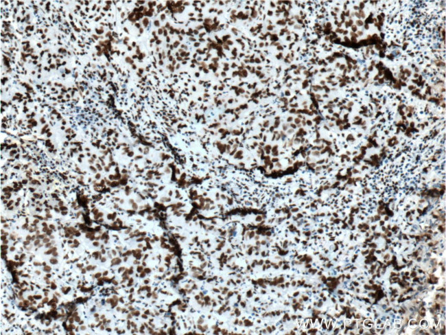 DACH1 Antibody in Immunohistochemistry (Paraffin) (IHC (P))