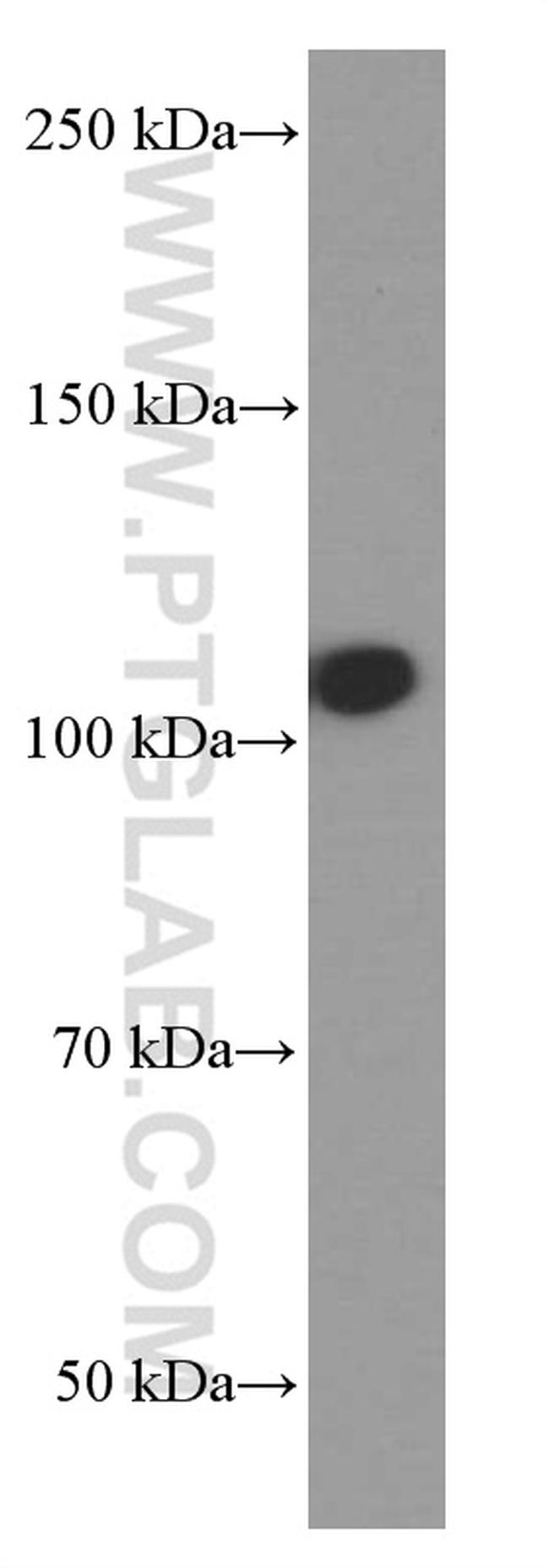 DACH1 Antibody in Western Blot (WB)