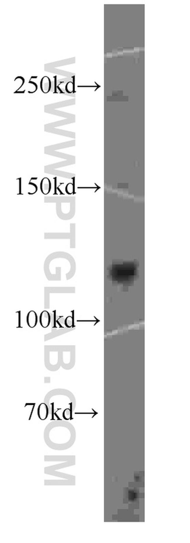 DGCR8 Antibody in Western Blot (WB)