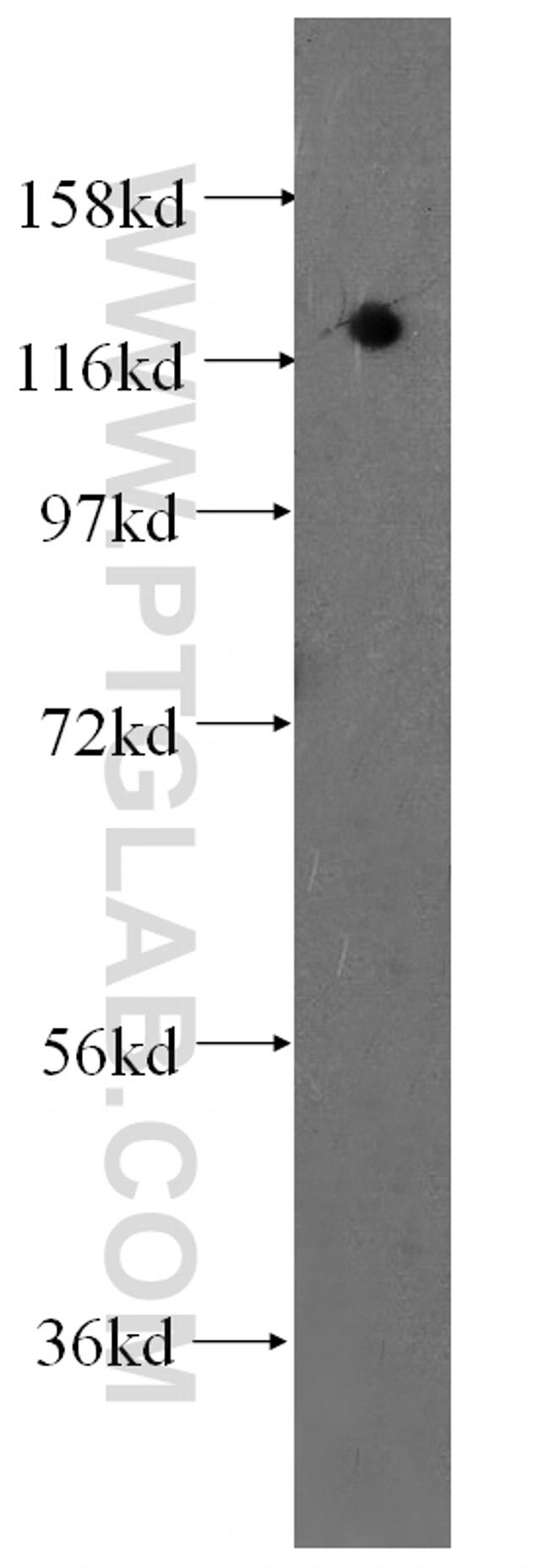 DGCR8 Antibody in Western Blot (WB)