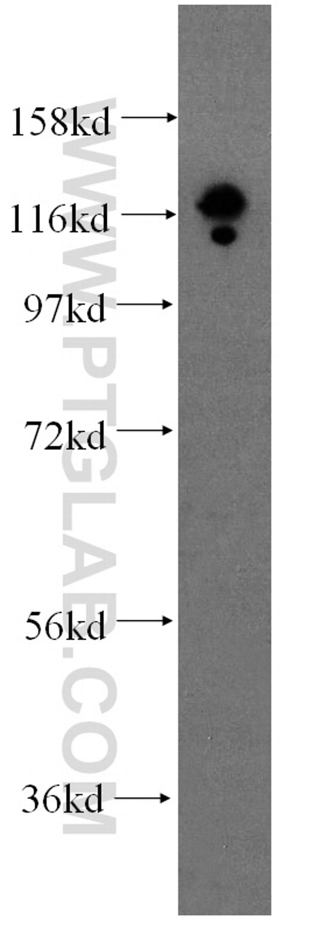 DGCR8 Antibody in Western Blot (WB)