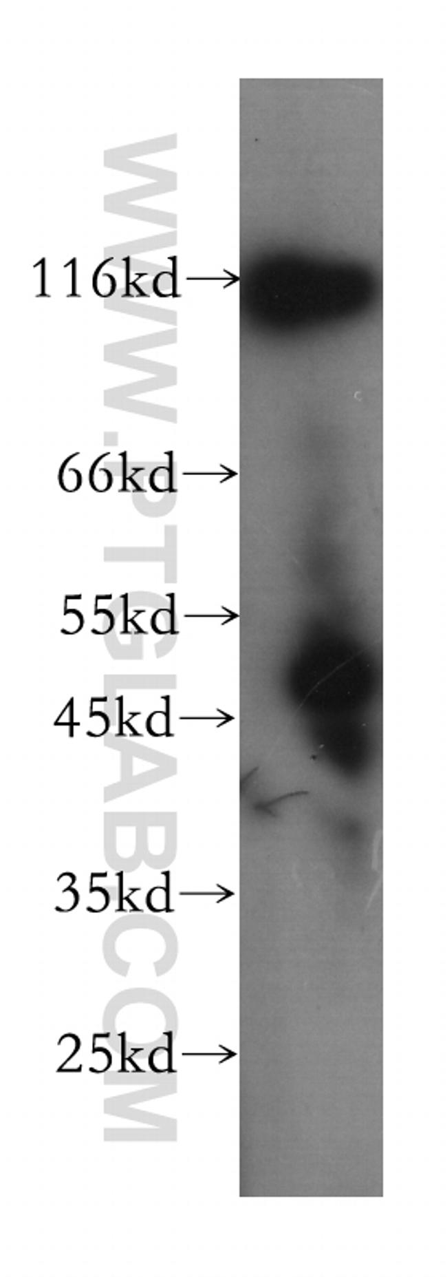 DGCR8 Antibody in Western Blot (WB)