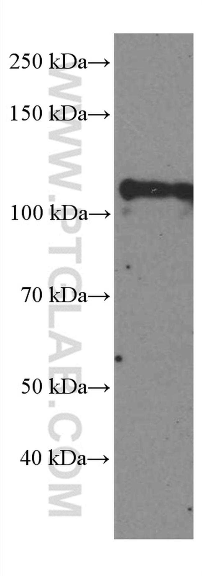 DGCR8 Antibody in Western Blot (WB)