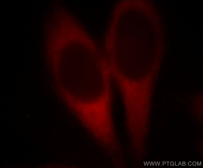 EEF1D Antibody in Immunocytochemistry (ICC/IF)