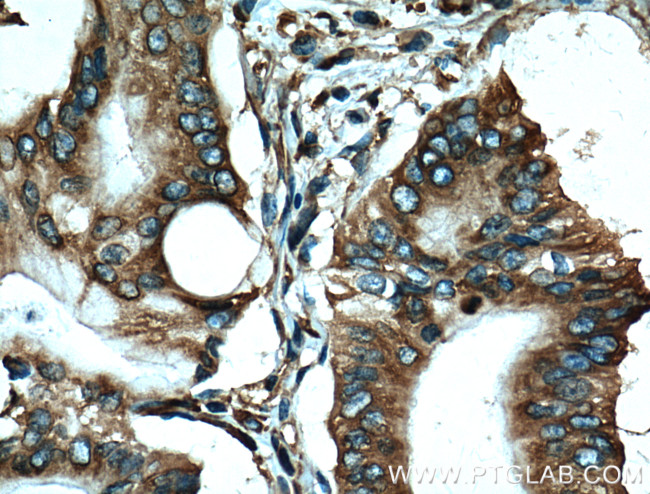 EEF1D Antibody in Immunohistochemistry (Paraffin) (IHC (P))