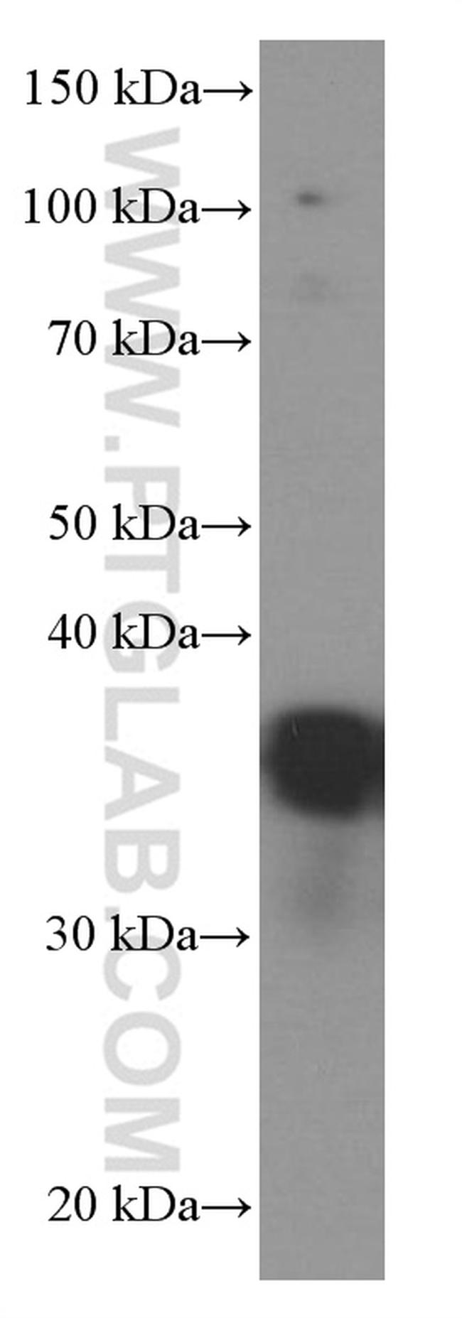 EEF1D Antibody in Western Blot (WB)