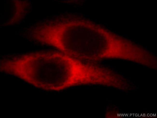 EEF1D Antibody in Immunocytochemistry (ICC/IF)