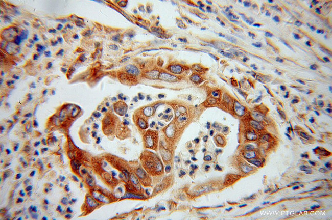 EEF1D Antibody in Immunohistochemistry (Paraffin) (IHC (P))