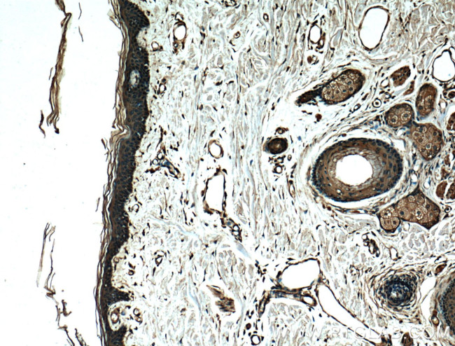 EEF1D Antibody in Immunohistochemistry (Paraffin) (IHC (P))