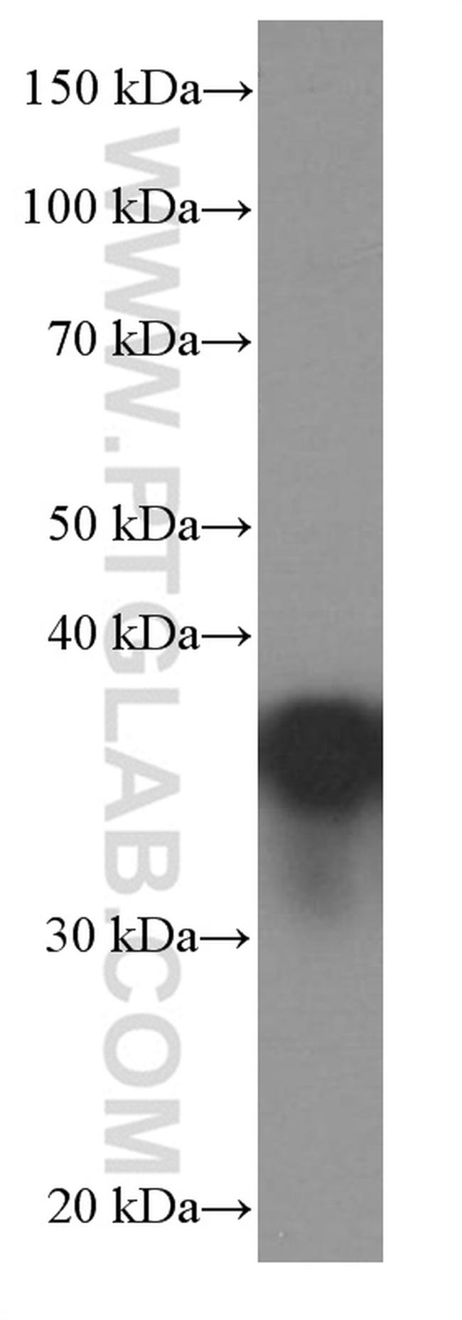 EEF1D Antibody in Western Blot (WB)