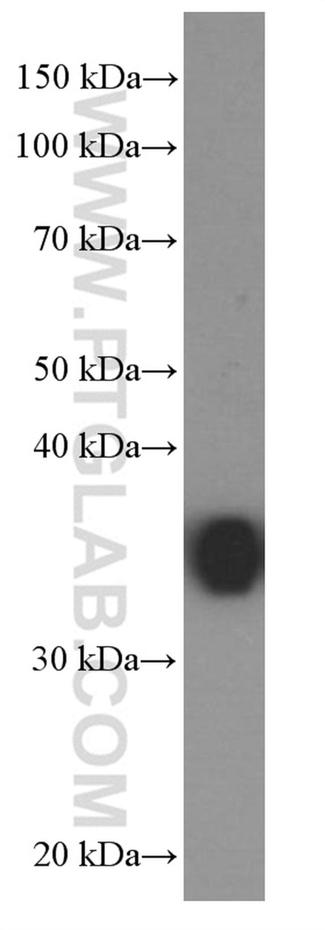 EEF1D Antibody in Western Blot (WB)