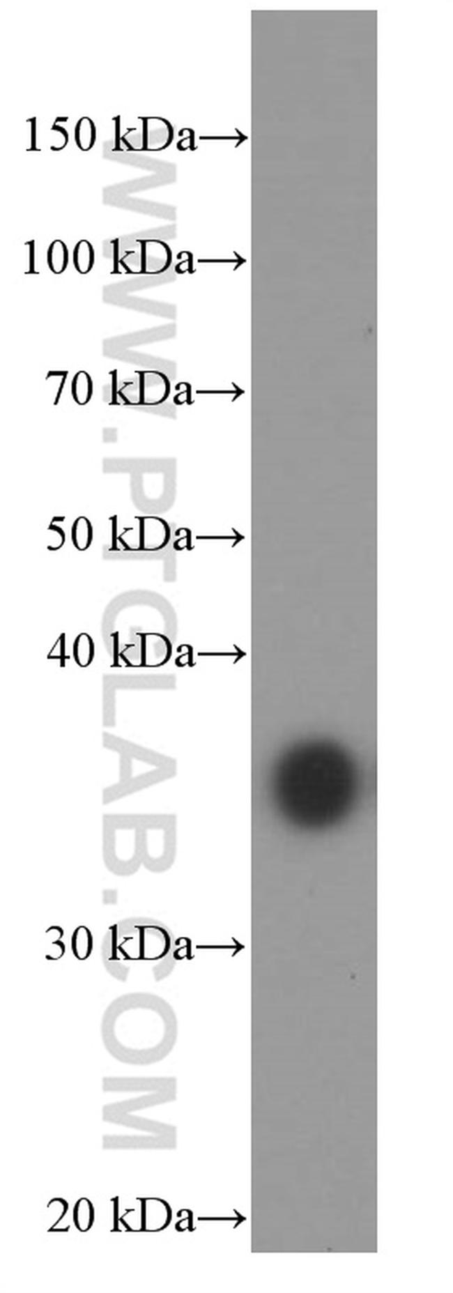 EEF1D Antibody in Western Blot (WB)