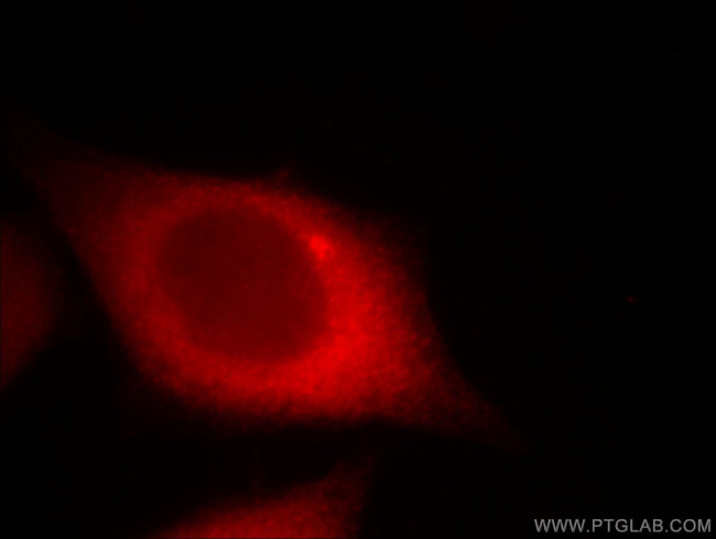 CTAGE1 Antibody in Immunocytochemistry (ICC/IF)