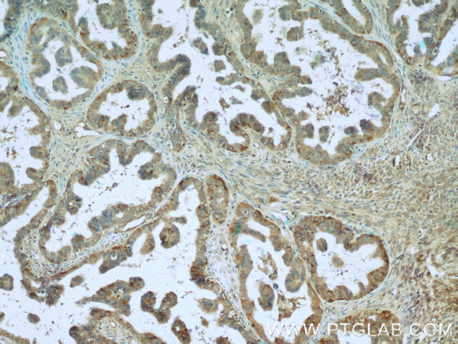 CTAGE1 Antibody in Immunohistochemistry (Paraffin) (IHC (P))