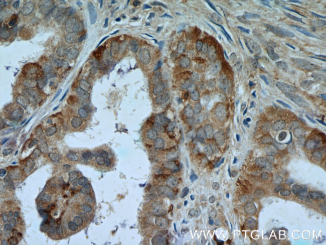 CTAGE1 Antibody in Immunohistochemistry (Paraffin) (IHC (P))