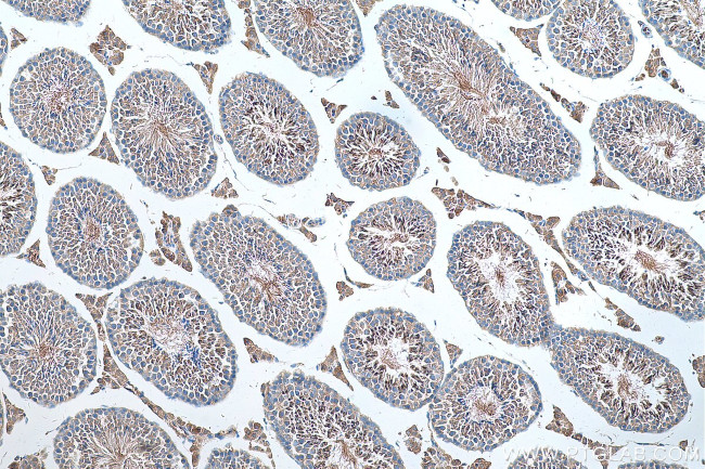 CTAGE1 Antibody in Immunohistochemistry (Paraffin) (IHC (P))