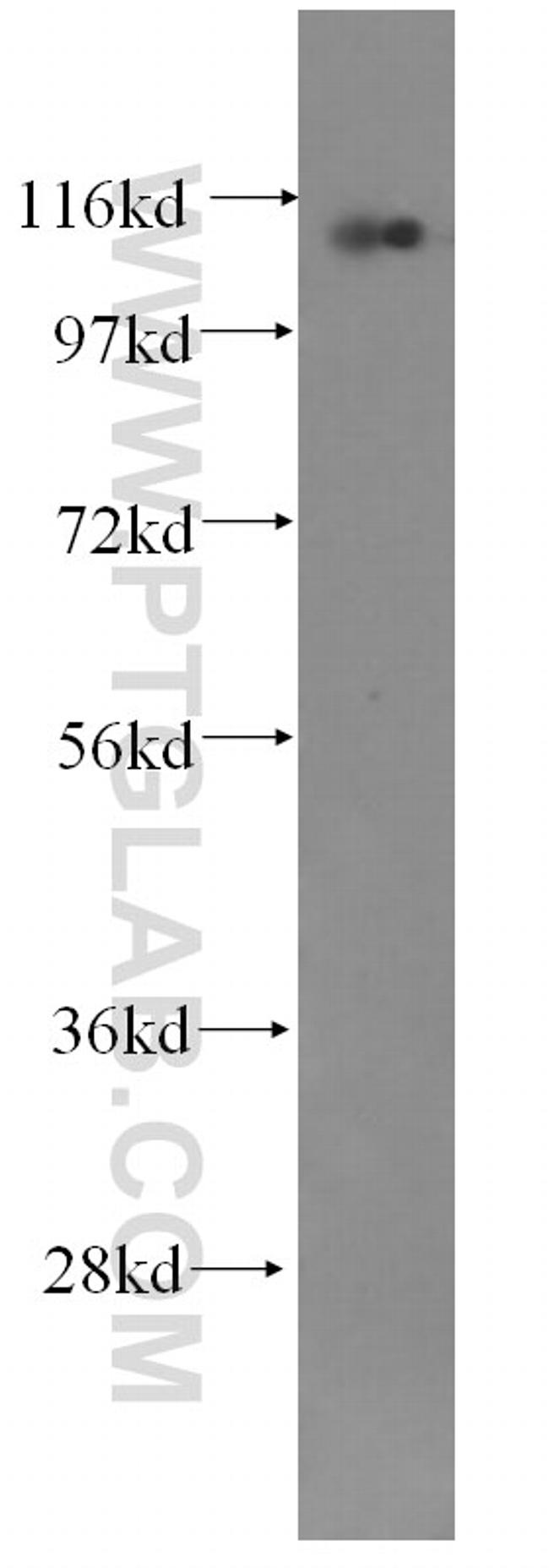 CTAGE1 Antibody in Western Blot (WB)