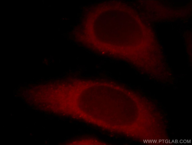 CTAGE1 Antibody in Immunocytochemistry (ICC/IF)