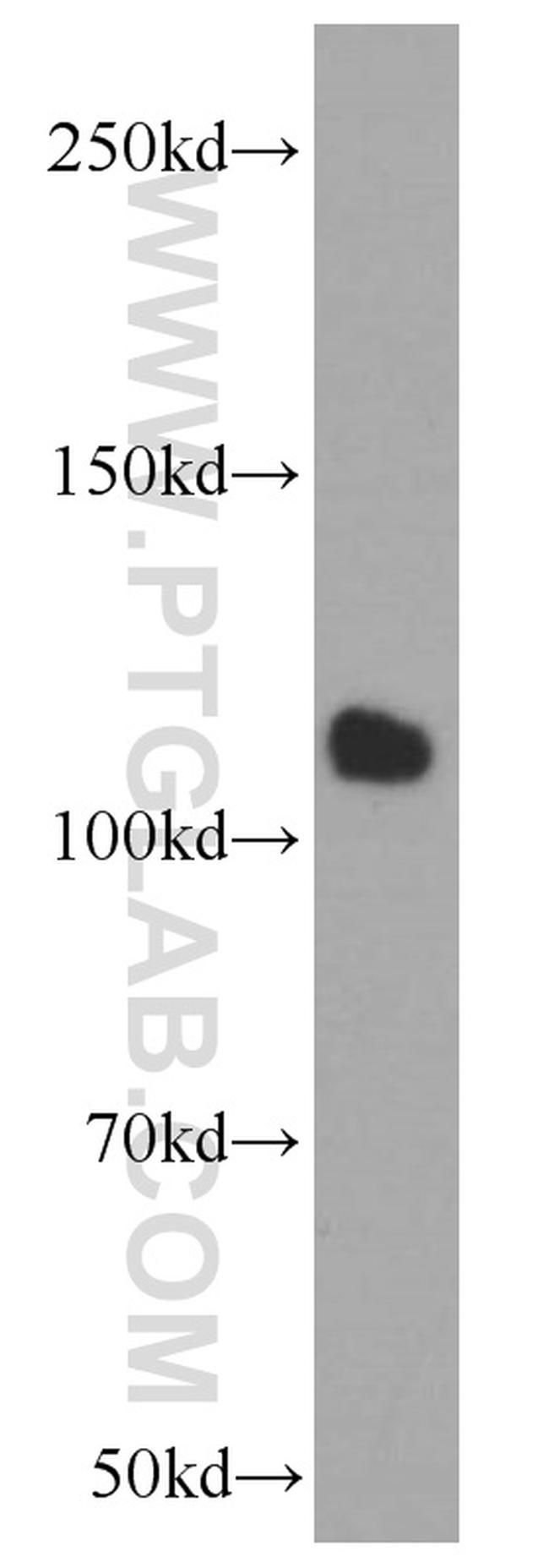 CTAGE1 Antibody in Western Blot (WB)