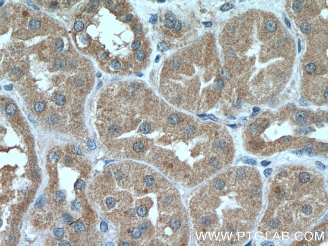 Prohibitin Antibody in Immunohistochemistry (Paraffin) (IHC (P))