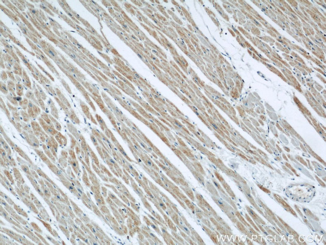 Prohibitin Antibody in Immunohistochemistry (Paraffin) (IHC (P))