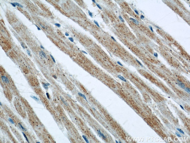 Prohibitin Antibody in Immunohistochemistry (Paraffin) (IHC (P))