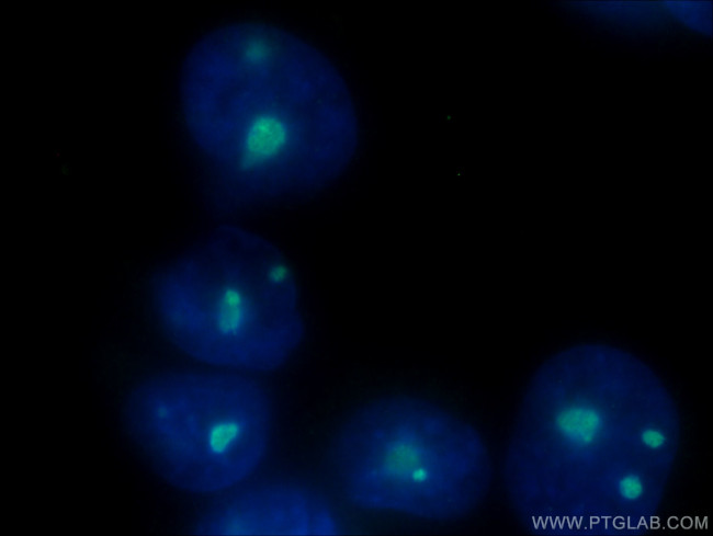 B23/NPM1 Antibody in Immunocytochemistry (ICC/IF)