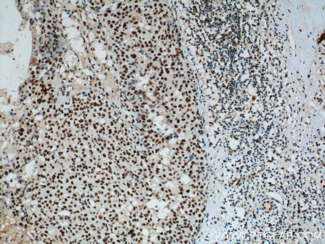 B23/NPM1 Antibody in Immunohistochemistry (Paraffin) (IHC (P))