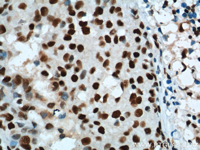 B23/NPM1 Antibody in Immunohistochemistry (Paraffin) (IHC (P))