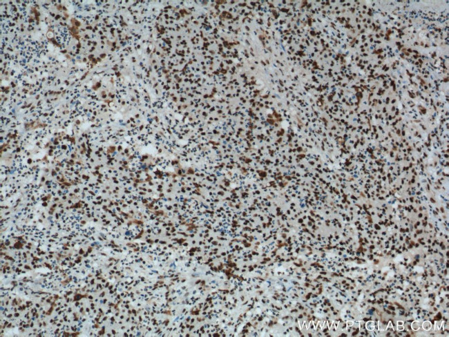 B23/NPM1 Antibody in Immunohistochemistry (Paraffin) (IHC (P))