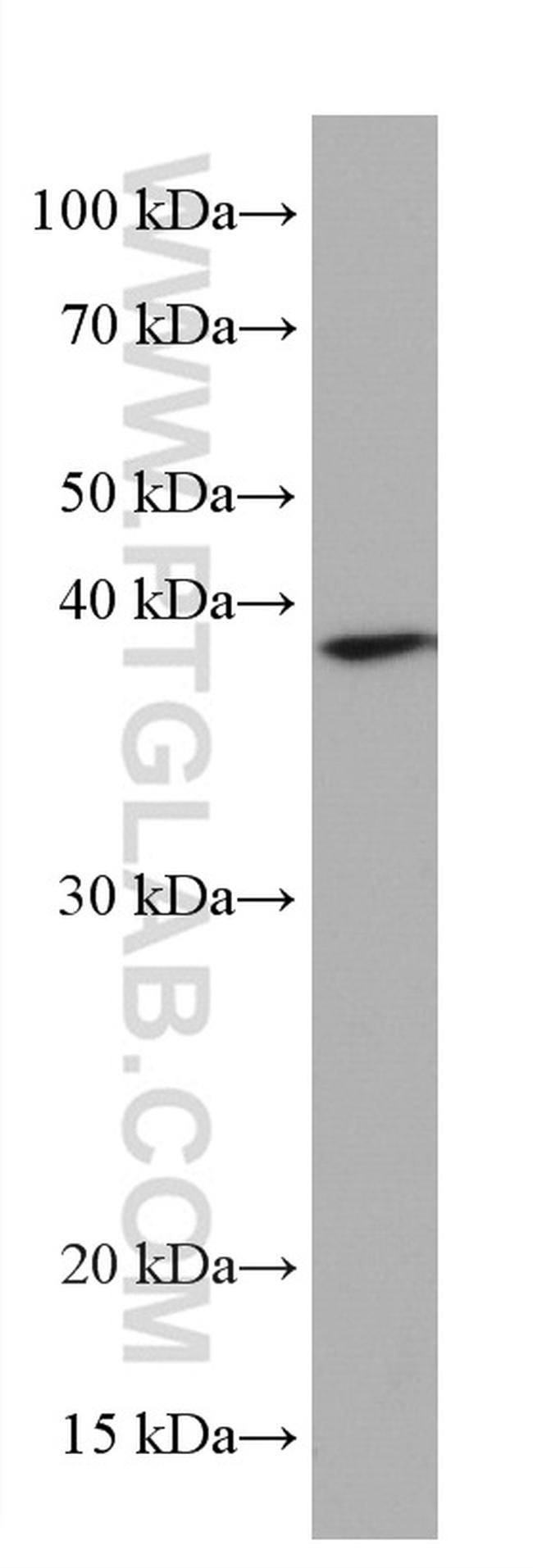 B23/NPM1 Antibody in Western Blot (WB)