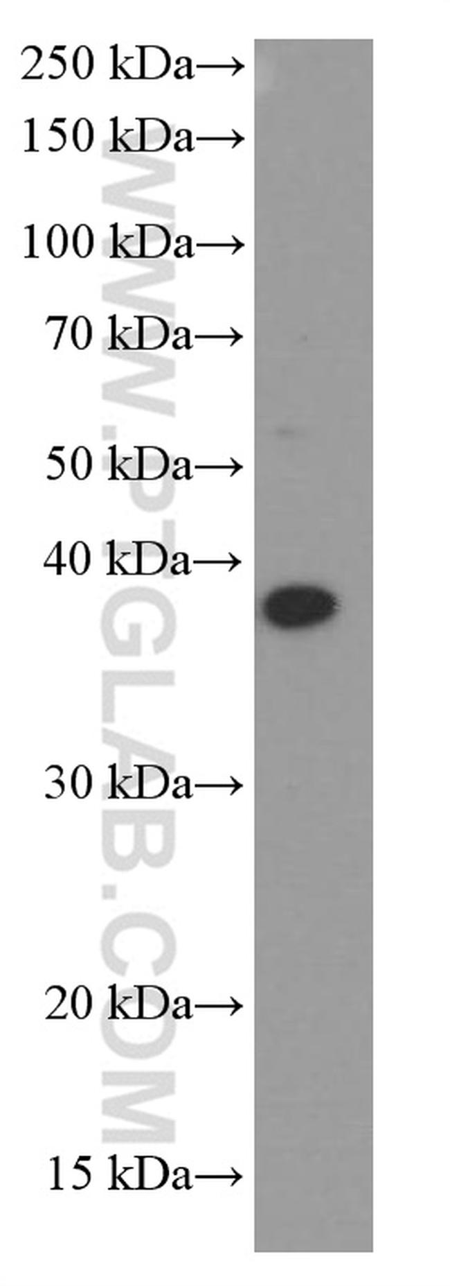 B23/NPM1 Antibody in Western Blot (WB)