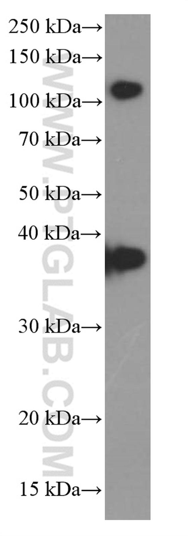 B23/NPM1 Antibody in Western Blot (WB)