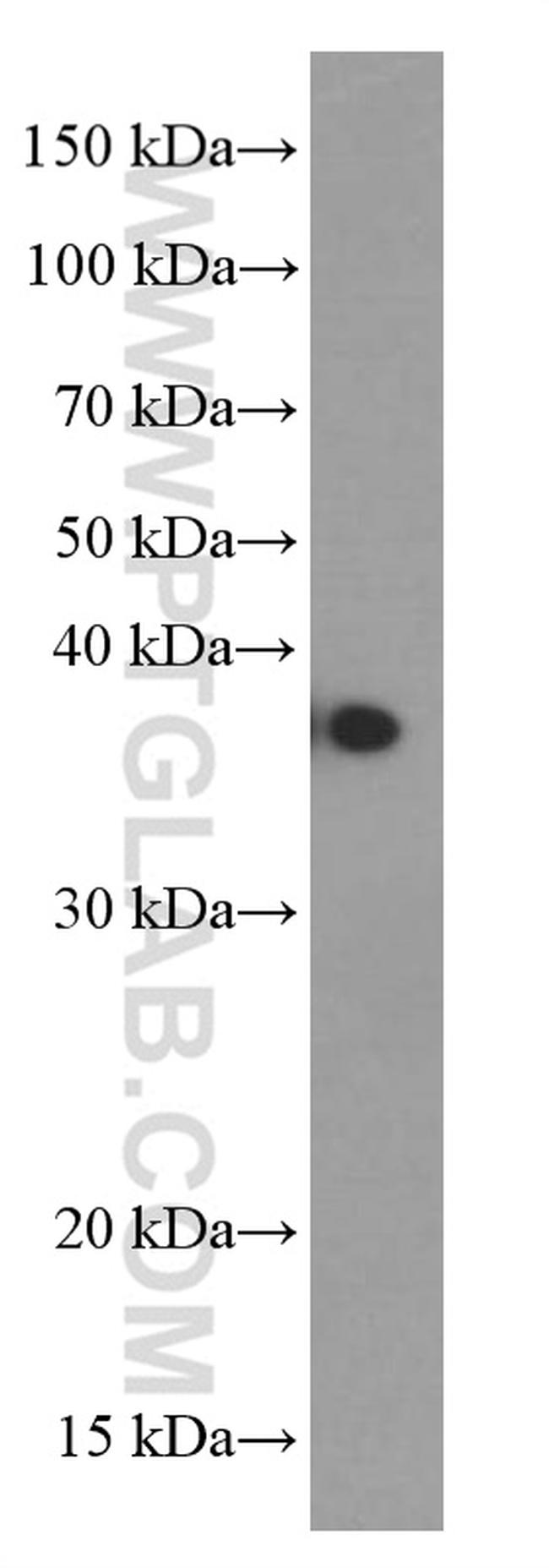 B23/NPM1 Antibody in Western Blot (WB)