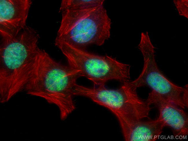 PCNA Antibody in Immunocytochemistry (ICC/IF)