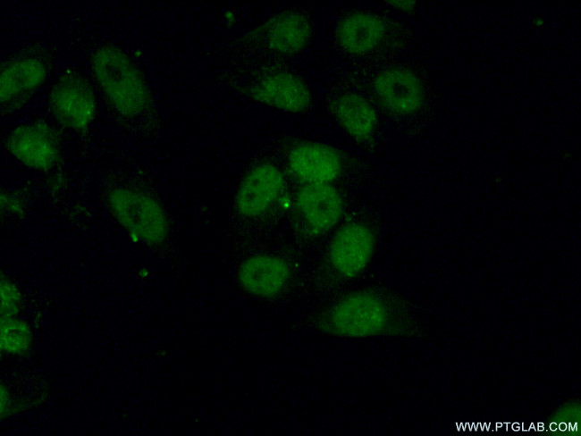 PCNA Antibody in Immunocytochemistry (ICC/IF)