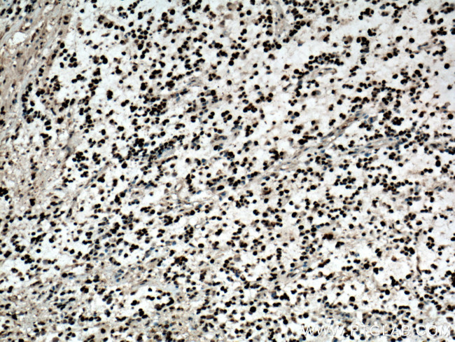 PCNA Antibody in Immunohistochemistry (Paraffin) (IHC (P))