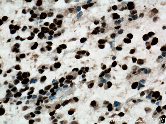 PCNA Antibody in Immunohistochemistry (Paraffin) (IHC (P))