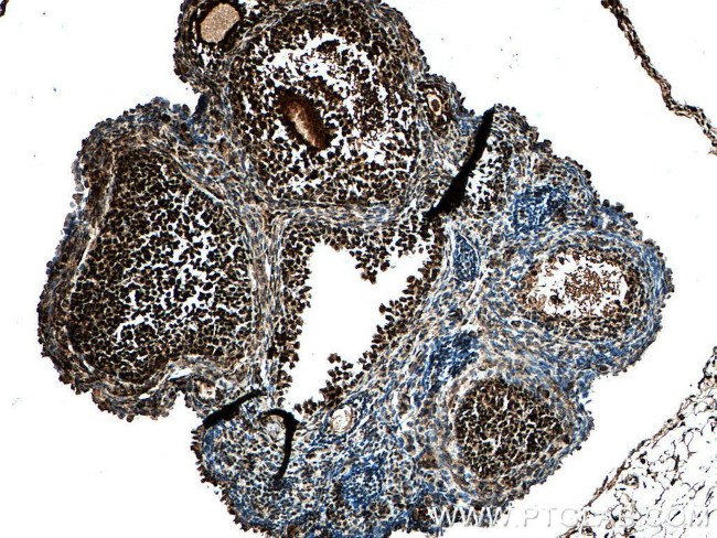 PCNA Antibody in Immunohistochemistry (Paraffin) (IHC (P))