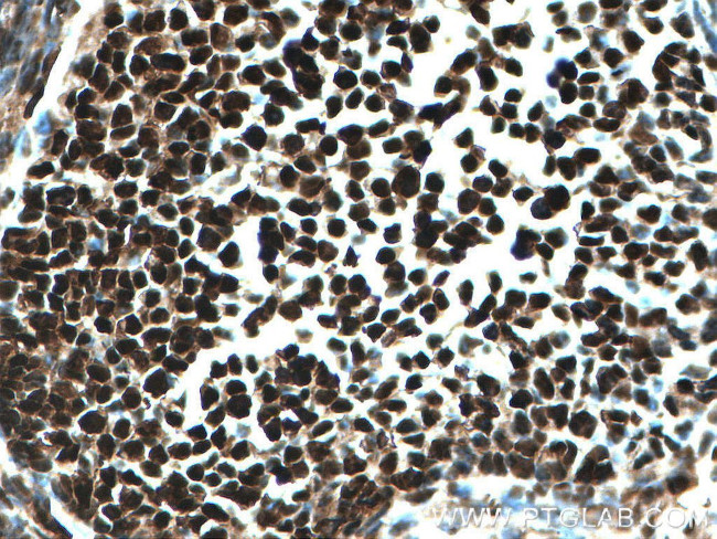 PCNA Antibody in Immunohistochemistry (Paraffin) (IHC (P))