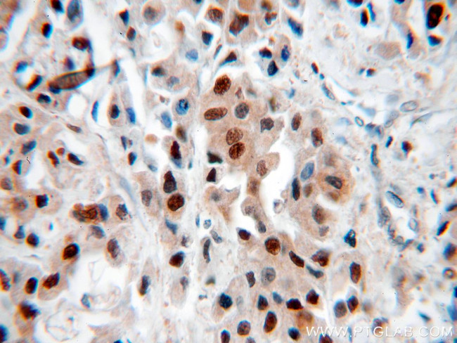 PCNA Antibody in Immunohistochemistry (Paraffin) (IHC (P))