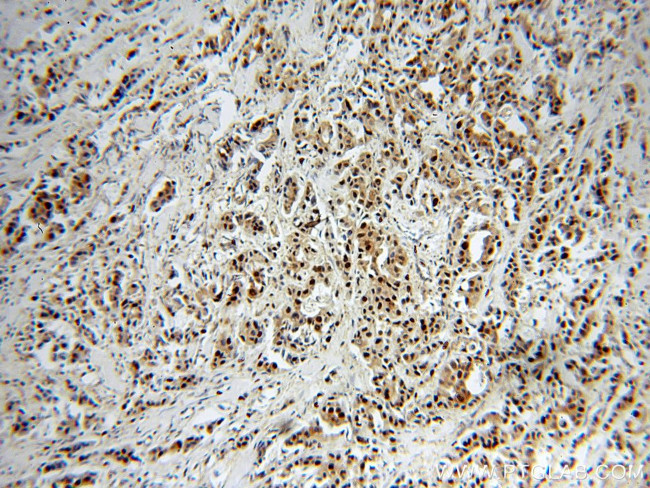 PCNA Antibody in Immunohistochemistry (Paraffin) (IHC (P))