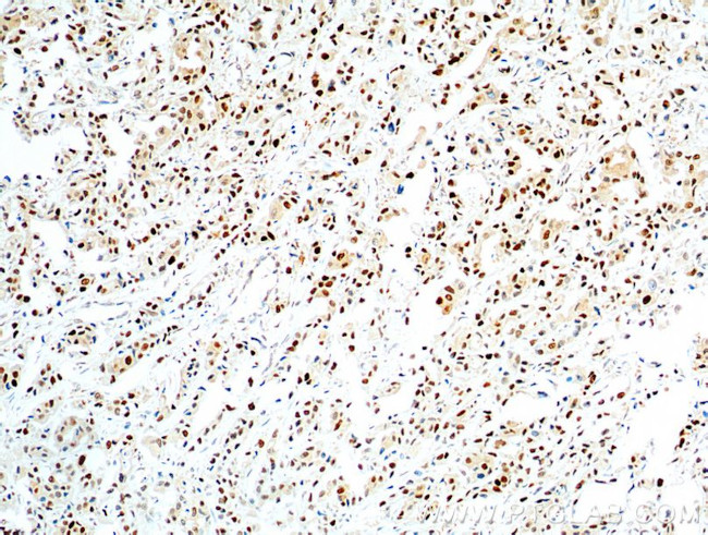 PCNA Antibody in Immunohistochemistry (Paraffin) (IHC (P))