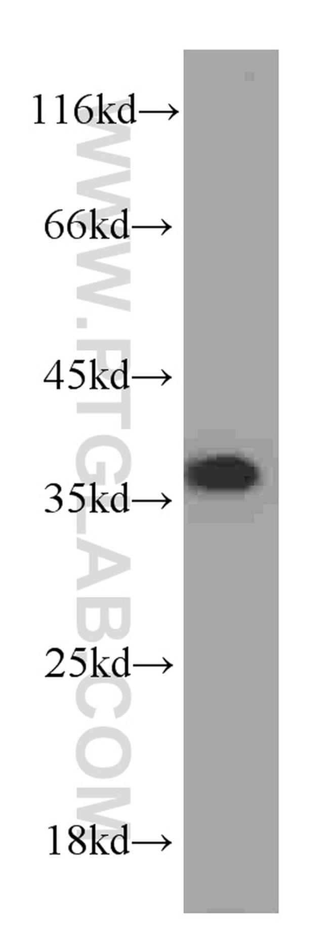 PCNA Antibody in Western Blot (WB)