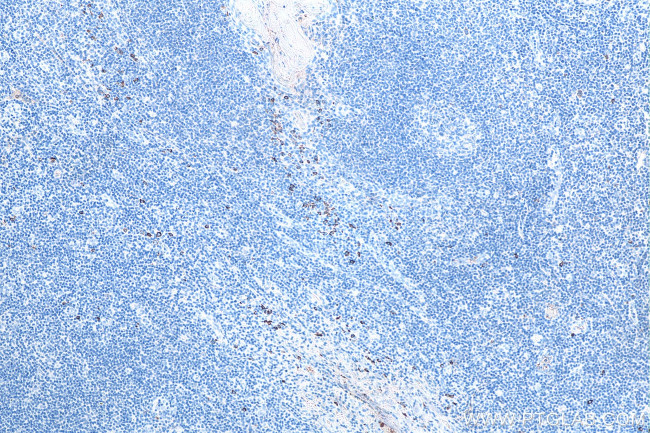 Human IgA Antibody in Immunohistochemistry (Paraffin) (IHC (P))