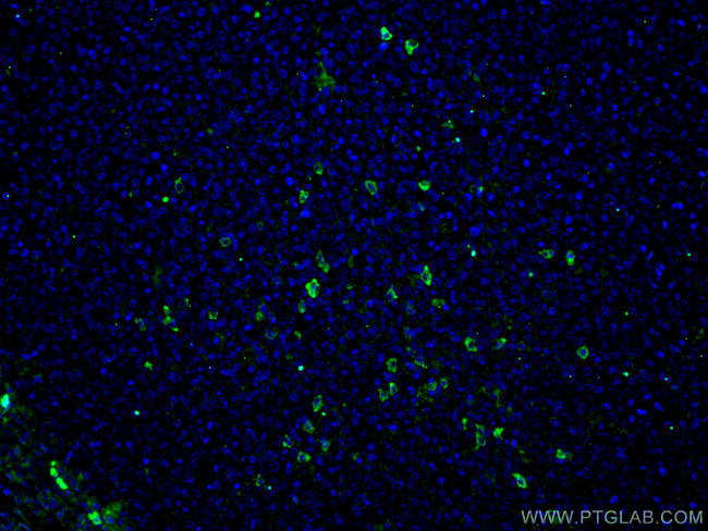 Human IgA Antibody in Immunohistochemistry (PFA fixed) (IHC (PFA))