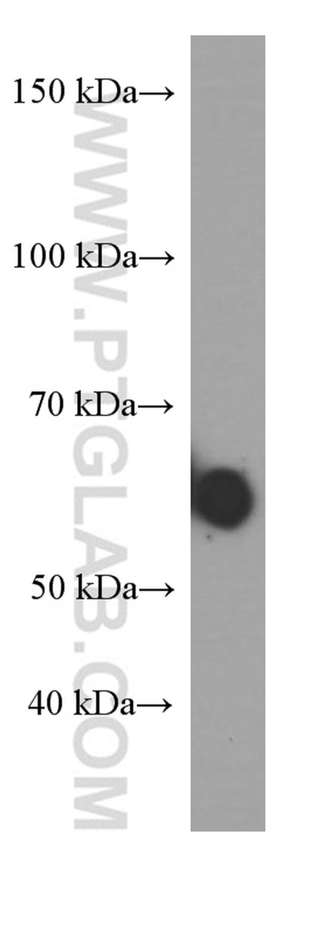 Human IgA Antibody in Western Blot (WB)